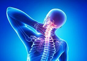 vjerojatne komplikacije sa spojem osteohondroze