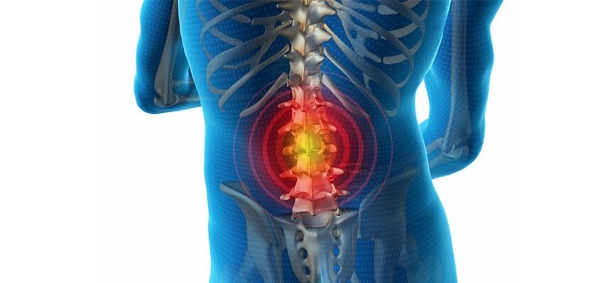 metode dijagnosticiranja bolova u leđima